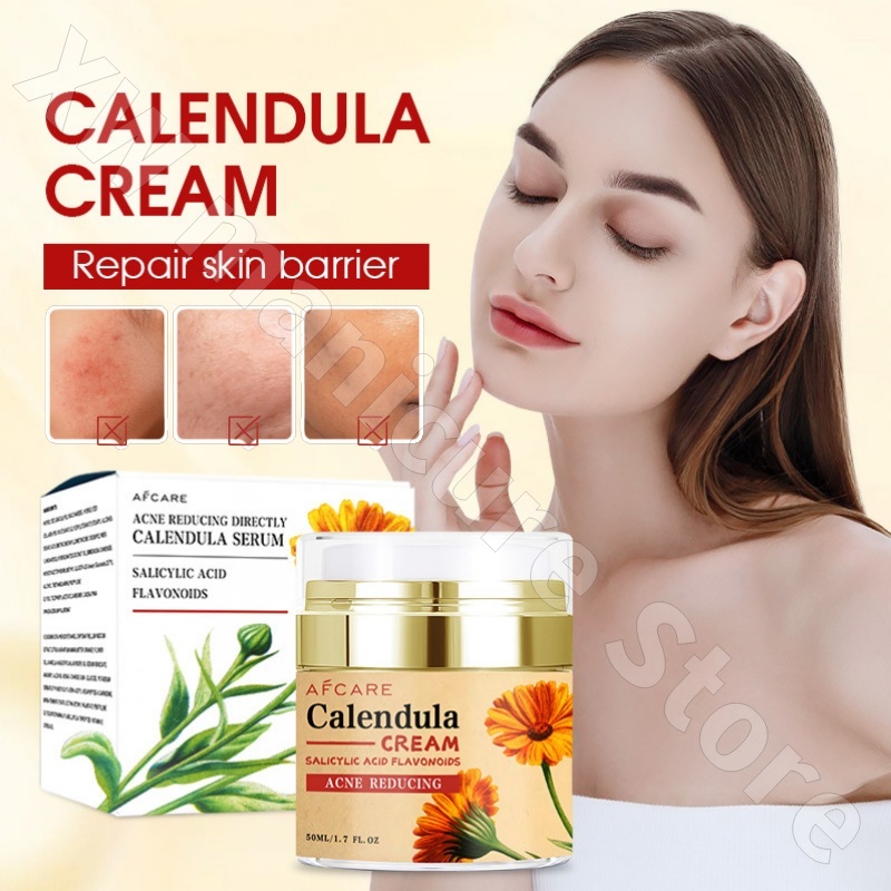 Luxury Skincare Whitening Cream - Crema reparadora de caléndula, crema hidratante